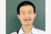 韦东奕牙齿引关注医生给出专业建议