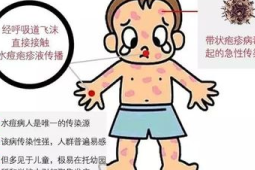 夏季战痘关键：保持皮肤正常呼吸