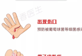 酒精是唯一彻底消毒伤口的方法吗