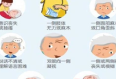 中风年轻化趋势早发现这些症状能救命
