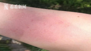 风筝线伤人事件频发为何禁放规定难阻放飞行为  第1张