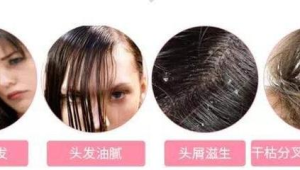 频繁洗头会导致脱发是真是假