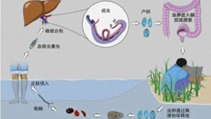 男子湖里游泳后出现血尿竟是虫子作祟预防方法速看  第1张