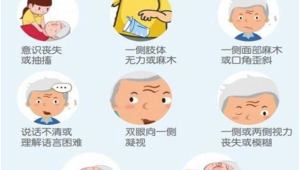 中风年轻化趋势早发现这些症状能救命  第1张