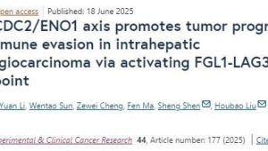 中国专家团队突破胆管癌分子诊断技术填补国际空白  第1张