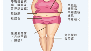 肥胖危害女性健康更甚  第1张