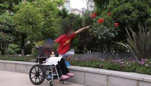亚洲首例异种肾移植患者术后体征平稳超天  第1张